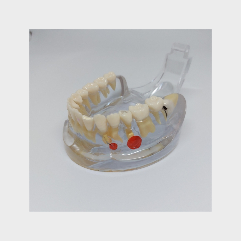 Transparent Sygdomsmodel